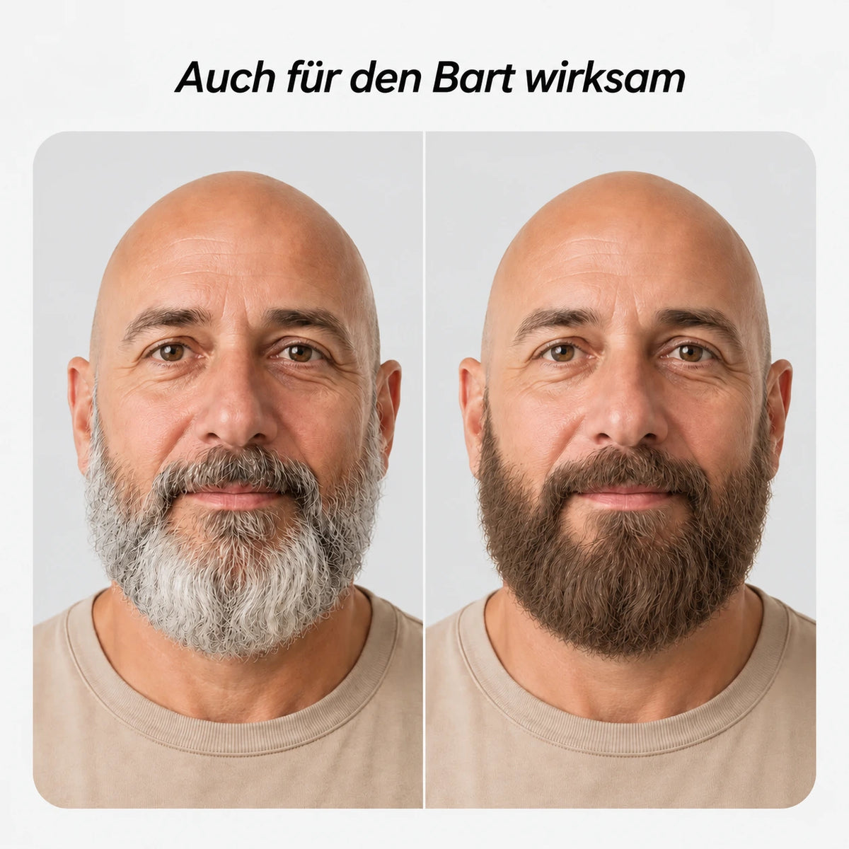 #Bart_Hellbraun