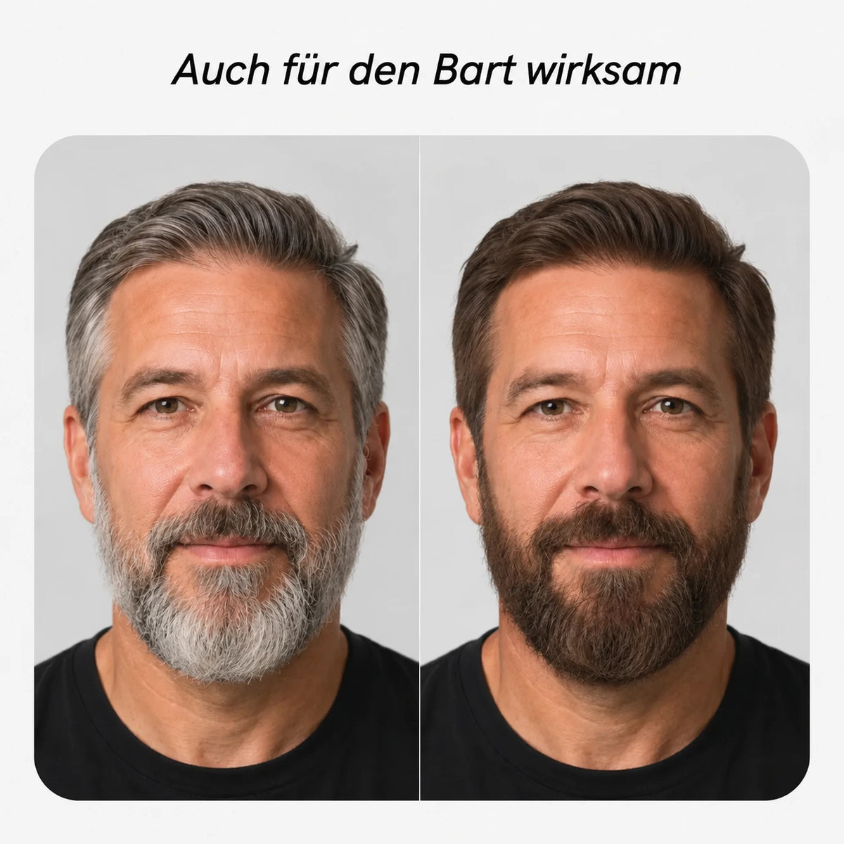 #Bart_Mittelbraun